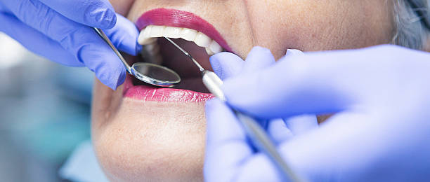 Best Emergency Dentist for Special Needs Patients in March Ar, CA